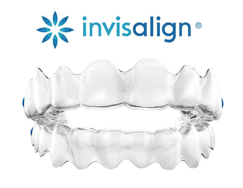 Invisalign Kitchener & Cambridge